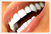 Teeth whitening at  Sundentalmuscat in Oman